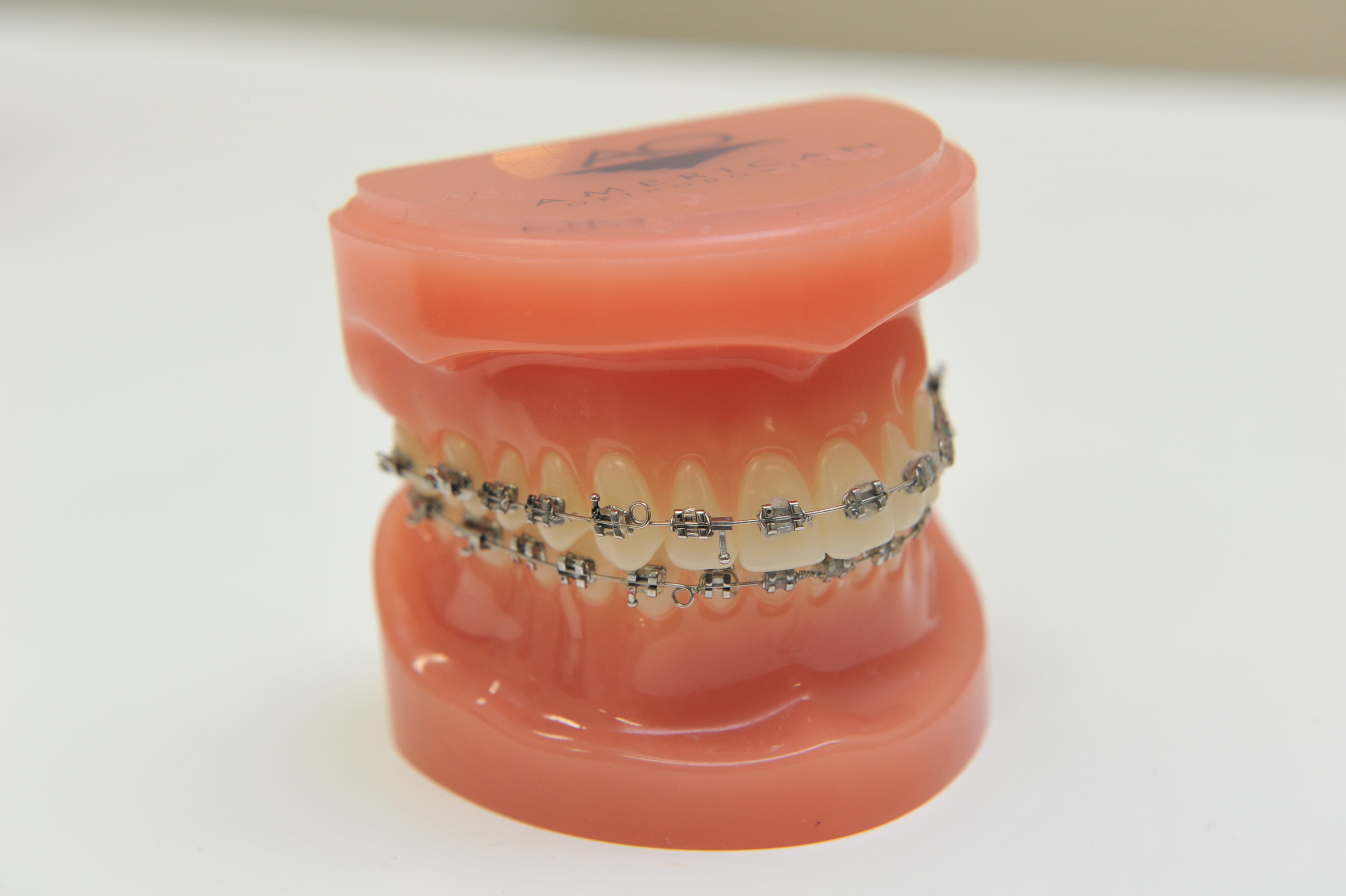患者様のご相談を紹介-前歯の歯列矯正のことで-