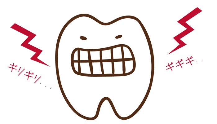 歯ぎしりや食いしばりによる影響