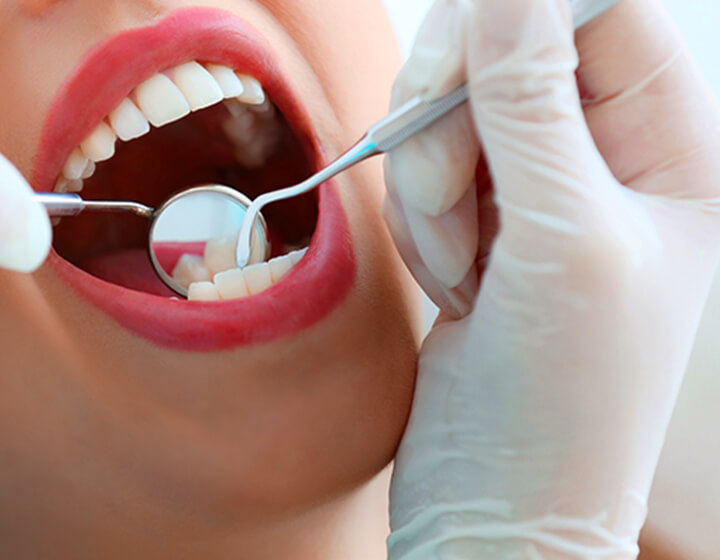 予防 「末永く健康の歯」