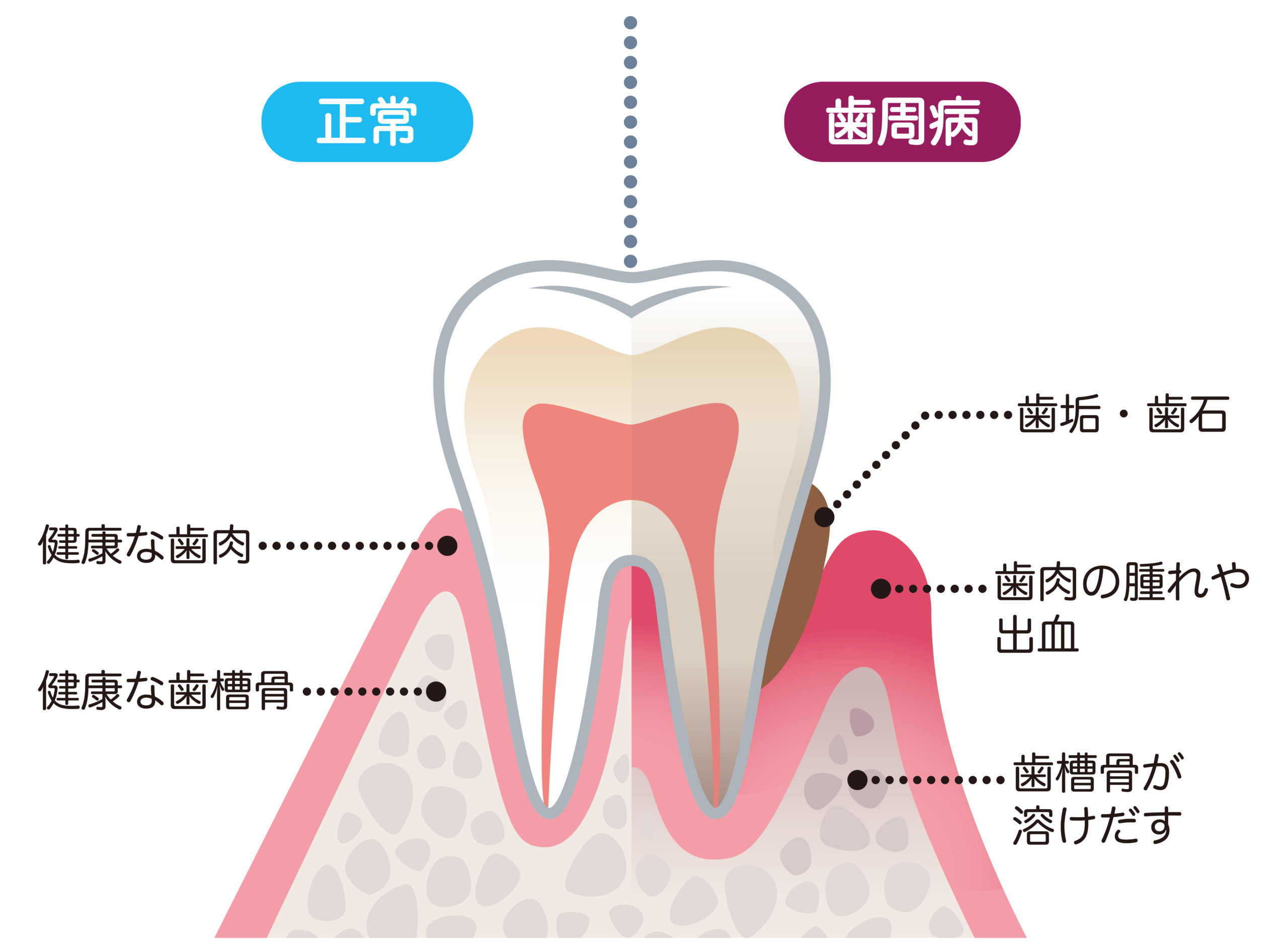 定期検診