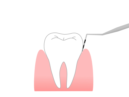 歯周病検査を受けよう！🦷