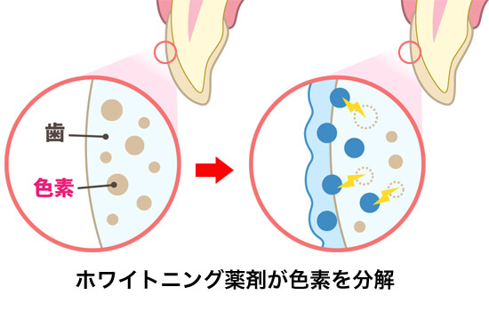 ホワイトニングのメカニズム🦷°˖✧